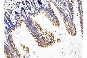 IHC analysis of LOR using anti-LOR antibody (ABIN6719582). (LOR antibody  (AA 1-312))