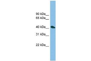 WB Suggested Anti-ZNF514 Antibody Titration: 0.
