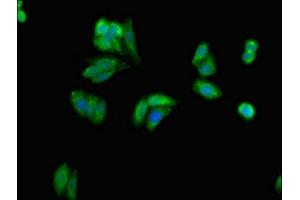 Immunofluorescent analysis of HepG2 cells using ABIN7154494 at dilution of 1:100 and Alexa Fluor 488-congugated AffiniPure Goat Anti-Rabbit IgG(H+L) (PIK3R1 antibody  (AA 15-180))