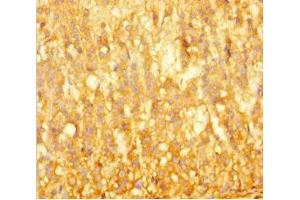 Immunohistochemistry of paraffin-embedded human adrenal gland tissue using ABIN7145808 at dilution of 1:100 (BRD3 antibody  (AA 356-506))