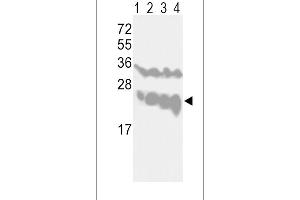 Western blot analysis of UCHL1-V31 in CEM(lane 1), Jurkat(lane 2), Y79(lane 3) cell line and mouse brain tissue(lane 4) lysates (35ug/lane) (UCHL1 antibody  (N-Term))