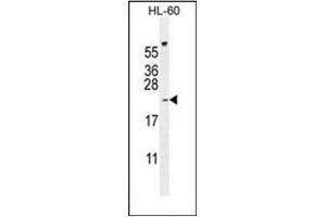 Western blot analysis of PLA2G2C Antibody (C-term) in HL-60 cell line lysates (35ug/lane). (PLA2G2C antibody  (C-Term))