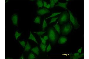 Immunofluorescence of monoclonal antibody to CDK4 on HeLa cell. (CDK4 antibody  (AA 211-303))