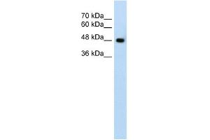 WB Suggested Anti-SLC38A1 Antibody Titration:  1. (SLC38A1 antibody  (Middle Region))