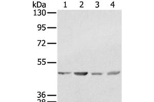 Western Blot analysis of K562, 231, Raji and hela cell using SSB Polyclonal Antibody at dilution of 1:400 (SSB antibody)
