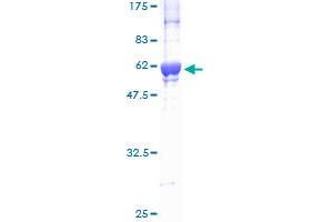 SDS-PAGE (SDS) image for Cyclin-Dependent Kinase 2 (CDK2) (AA 1-298) protein (GST tag) (ABIN1348934) (CDK2 Protein (AA 1-298) (GST tag))