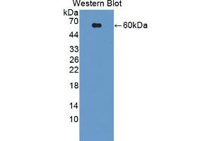 Detection of Recombinant USP14, Human using Polyclonal Antibody to Ubiquitin Specific Peptidase 14 (USP14) (USP14 antibody  (AA 1-494))