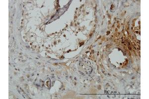Immunoperoxidase of monoclonal antibody to TRIM49 on formalin-fixed paraffin-embedded human testis. (TRIM49 antibody  (AA 251-340))