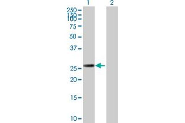 RAD51D antibody  (AA 1-216)