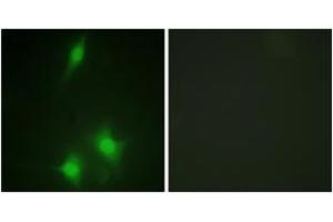 Immunofluorescence analysis of NIH-3T3 cells, using MDM2 (Ab-186/188) Antibody. (MDM2 antibody  (AA 151-200))