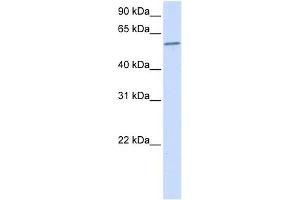 PPP3CA antibody used at 1 ug/ml to detect target protein. (PPP3CA antibody)