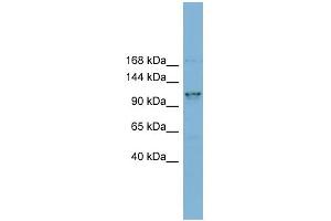 WB Suggested Anti-CCDC87 Antibody Titration: 0. (CCDC87 antibody  (N-Term))
