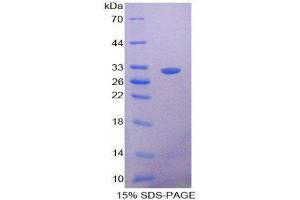 SDS-PAGE (SDS) image for Nitric Oxide Synthase Trafficker (NOSTRIN) (AA 18-251) protein (His tag) (ABIN2126101)