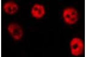 ABIN6275339 staining HepG2 by IF/ICC. (PRRX1 antibody  (Internal Region))
