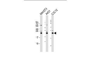 All lanes : Anti-RAB7 Antibody (C-term) at 1:2000 dilution Lane 1: NIH/3T3 whole cell lysate Lane 2: A431 whole cell lysate Lane 3: C2C12 whole cell lysate Lysates/proteins at 20 μg per lane. (RAB7A antibody  (C-Term))