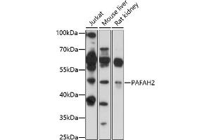 Western blot analysis of extracts of various cell lines, using P antibody (ABIN7269402) at 1:1000 dilution. (PAFAH2 antibody  (AA 260-350))