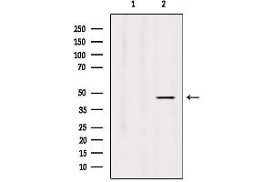 Western blot analysis of extracts from Hela, using L2HGDH Antibody. (L2HGDH antibody  (Internal Region))