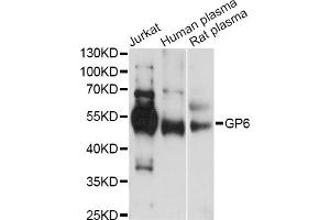 Western blot analysis of extracts of various cell lines, using GP6 antibody (ABIN6293681) at 1:1000 dilution. (GP6 antibody)