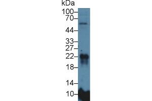 Western Blot; Sample: Rat Lung lysate; Primary Ab: 5µg/ml Rabbit Anti-Rat MFAP5 Antibody Second Ab: 0.