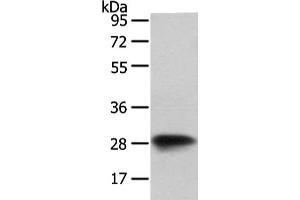 Gel: 8 % SDS-PAGE, Lysate: 40 μg, Lane: NIH/3T3 cell, Primary antibody: ABIN7128073(VAPA Antibody) at dilution 1/400 dilution, Secondary antibody: Goat anti rabbit IgG at 1/8000 dilution, Exposure time: 1 second