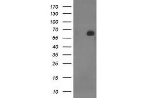 HEK293T cells were transfected with the pCMV6-ENTRY control (Left lane) or pCMV6-ENTRY SH2B3 (Right lane) cDNA for 48 hrs and lysed. (SH2B3 antibody)