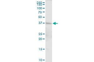 Western Blotting (WB) image for anti-DNA Fragmentation Factor, 45kDa, alpha Polypeptide (DFFA) (AA 1-331) antibody (ABIN514954)