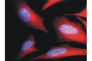 Immunofluorescence staining of HeLa human cervix carcinoma cell line using anti-alpha-tubulin (; red). (alpha Tubulin antibody  (Biotin))