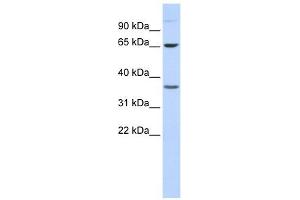 Epsin 2 antibody used at 1 ug/ml to detect target protein. (Epsin 2 antibody  (Middle Region))