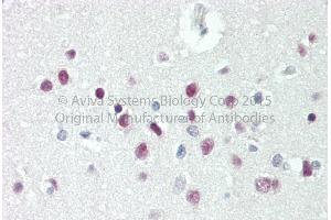 Rabbit Anti-TBX15 antibody   Formalin Fixed Paraffin Embedded Tissue: Human Adult Brain, cortex  Observed Staining: Cytoplasm in hepatocytes Primary Antibody Concentration: 1:600 Secondary Antibody: Donkey anti-Rabbit-Cy3 Secondary Antibody Concentration: 1:200 Magnification: 20X Exposure Time: 0.