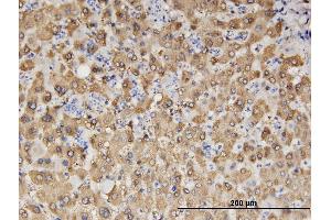 Immunoperoxidase of monoclonal antibody to ALDH1A1 on formalin-fixed paraffin-embedded human liver. (ALDH1A1 antibody  (AA 1-501))