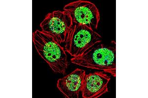 Fluorescent confocal image of A549 cell stained with FOXG1 Antibody (Center) (ABIN653750 and ABIN2843050). (FOXG1 antibody  (AA 225-252))