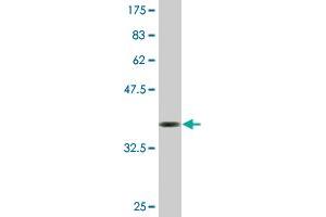 Western Blot detection against Immunogen (36. (SMC3 antibody  (AA 711-810))