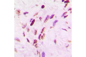 Immunohistochemistry (IHC) image for anti-Tumor Protein P53 (TP53) (acLys319), (C-Term) antibody (ABIN7301400)