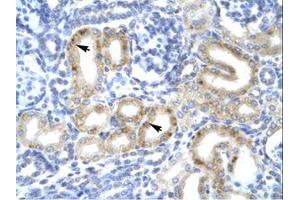 Image no. 1 for anti-T-Box 1 (TBX1) (AA 396-445) antibody (ABIN202658) (T-Box 1 antibody  (AA 396-445))
