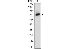 Western blot analysis using ZAP70 mouse mAb against MOLT4 (1) cell lysate. (ZAP70 antibody  (AA 169-390))