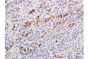Immunohistochemistry (Paraffin-embedded Sections) (IHC (p)) image for anti-Catalase (CAT) (AA 251-350) antibody (ABIN872991)