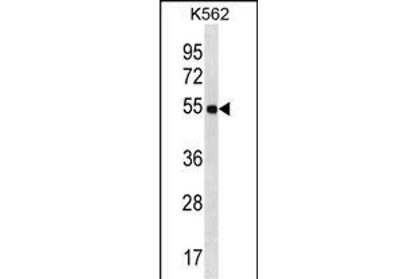 LAX1 antibody  (C-Term)