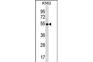LAX1 Antibody (C-term) (ABIN1537207 and ABIN2850101) western blot analysis in K562 cell line lysates (35 μg/lane). (LAX1 antibody  (C-Term))