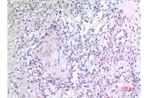 Immunohistochemistry (IHC) image for anti-VGF Nerve Growth Factor Inducible (VGF) (Internal Region) antibody (ABIN6284063)