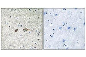 Immunohistochemistry (IHC) image for anti-MAP-Kinase Activating Death Domain (MADD) (Internal Region) antibody (ABIN1849836) (MADD antibody  (Internal Region))