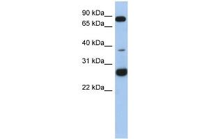 WB Suggested Anti-C1orf110 Antibody Titration: 0. (C1ORF110 antibody  (N-Term))