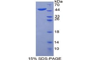 Image no. 1 for Keratin 20 (KRT20) (AA 9-424) protein (His tag) (ABIN4988639) (KRT20 Protein (AA 9-424) (His tag))