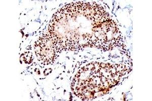 IHC staining of human tonsil with SUMO1 antibody (SM1/495). (SUMO1 antibody)