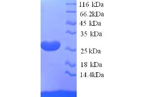 SDS-PAGE (SDS) image for Ephrin A5 (EFNA5) (AA 21-203) protein (His tag) (ABIN5713414)
