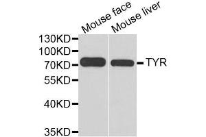 Western blot analysis of extracts of various cell lines, using TYR antibody. (TYR antibody  (AA 20-340))