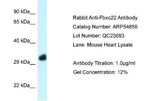 Western Blotting (WB) image for anti-F-Box Protein 22 (FBXO22) (Middle Region) antibody (ABIN2785926) (FBXO22 antibody  (Middle Region))