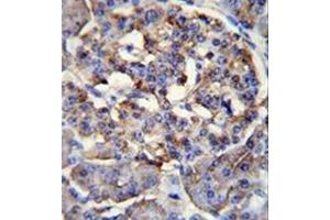 Immunohistochemistry analysis in formalin fixed and paraffin embedded human pancreas tissue reacted with LRRC68 Antibody (N-term) followed which was followed peroxidase conjugated to the secondary antibody followed by DAB staining.