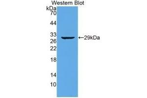 Detection of Recombinant TTN, Human using Monoclonal Antibody to Titin (TTN) (Titin antibody  (AA 33779-34025))