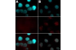 Histone H2AX phospho Ser139 antibody tested by immunofluorescence. (H2AFX antibody  (pSer139))