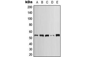 Western blot analysis of Cytokeratin 7 expression in HeLa (A), SP2/0 (B), H9C2 (C), A431 (D), NIH3T3 (E) whole cell lysates.